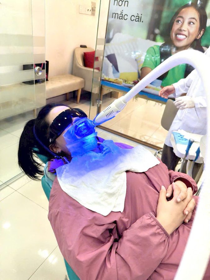 Tẩy trắng răng bằng Laser tại Chi Chi Dental